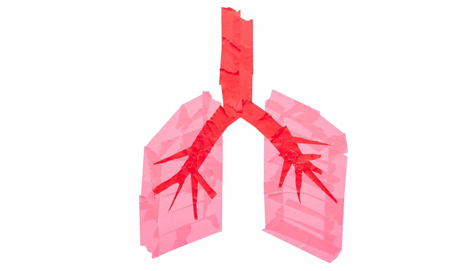 New Therapy Shows Promise in Fighting Drug-Resistant Lung Cancer