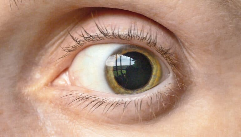 Why do your pupils dilate when you’re surprised?