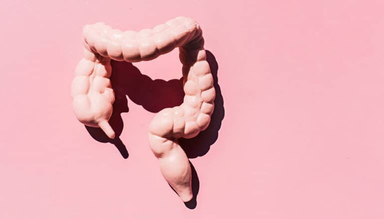 Study challenges long-held idea about colorectal cancer