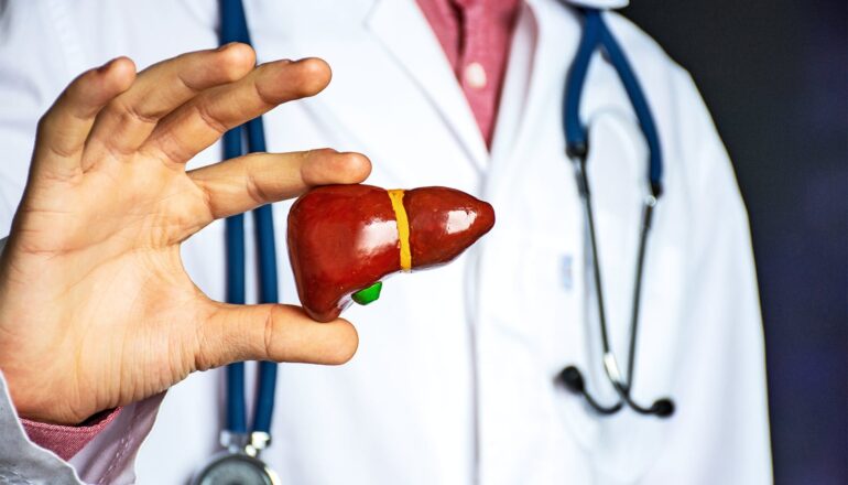 Exercise rewires liver metabolism differently based on sex