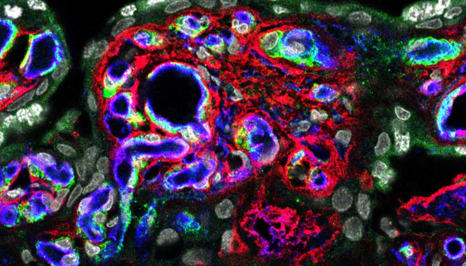 Placenta protein brain development